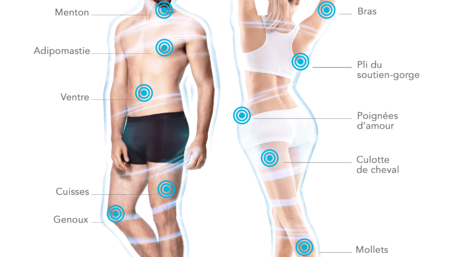 guide postoperatoire cryolipolyse