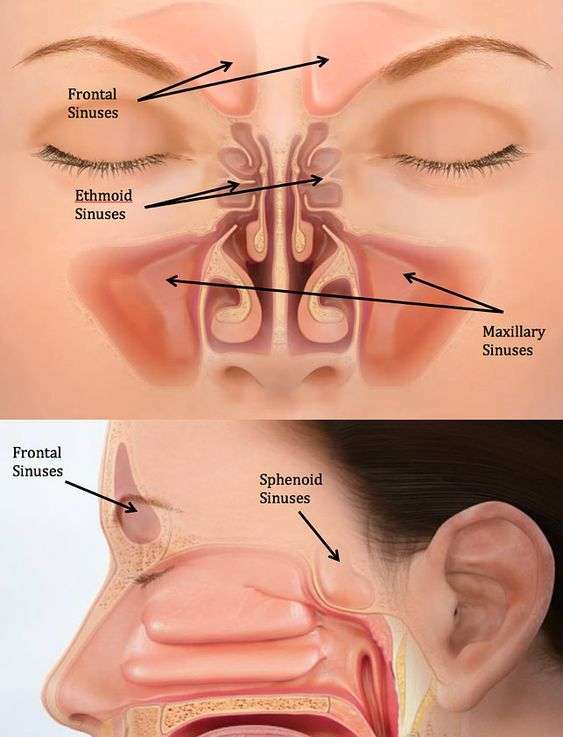 Chirurgie fracture du sinus : prix opération - Dr Abidi