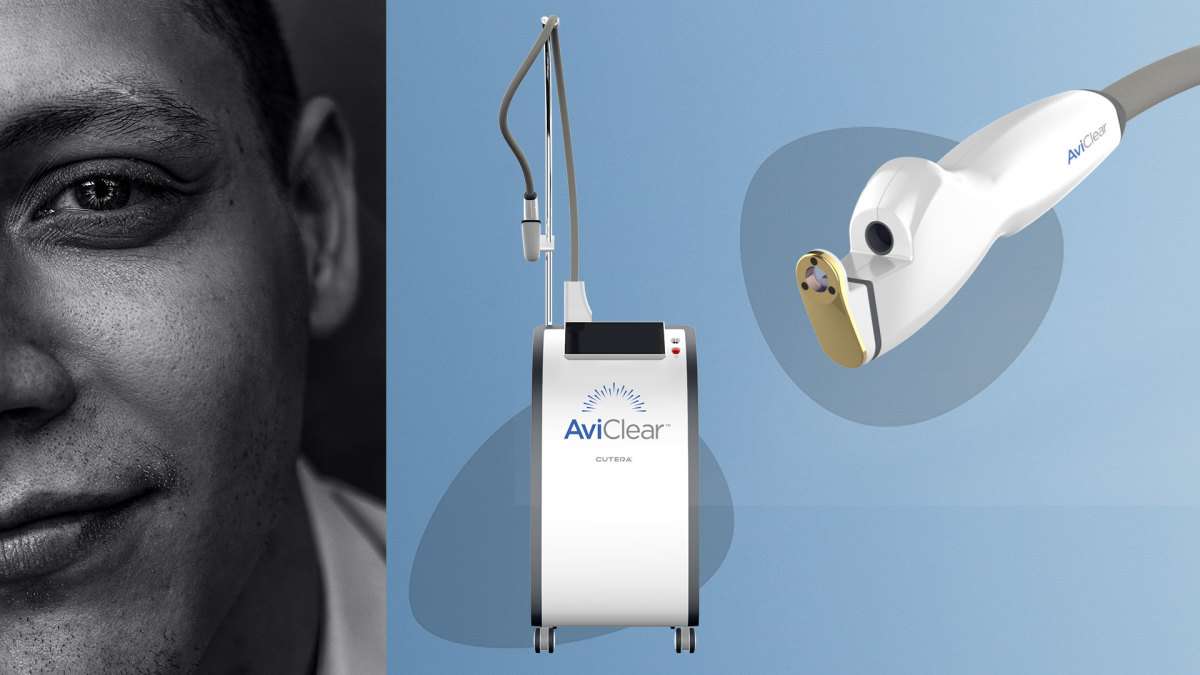 AviClear® technologie laser contre l'acné