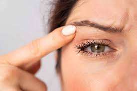 Chirurgie esthetique yeux laser