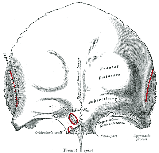 chirurgie fracture arcade sourcilière