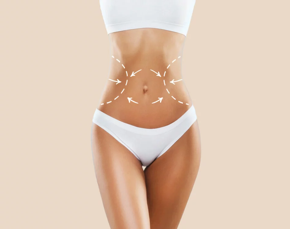 prix chirurgie esthetique liposuccion bodytite tunisie