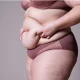 deuxième abdominoplastie